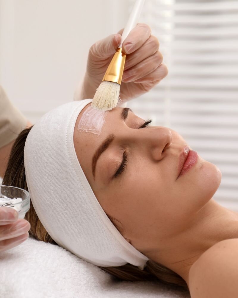 Chemisches Peeling bei Aesthetika Peponi